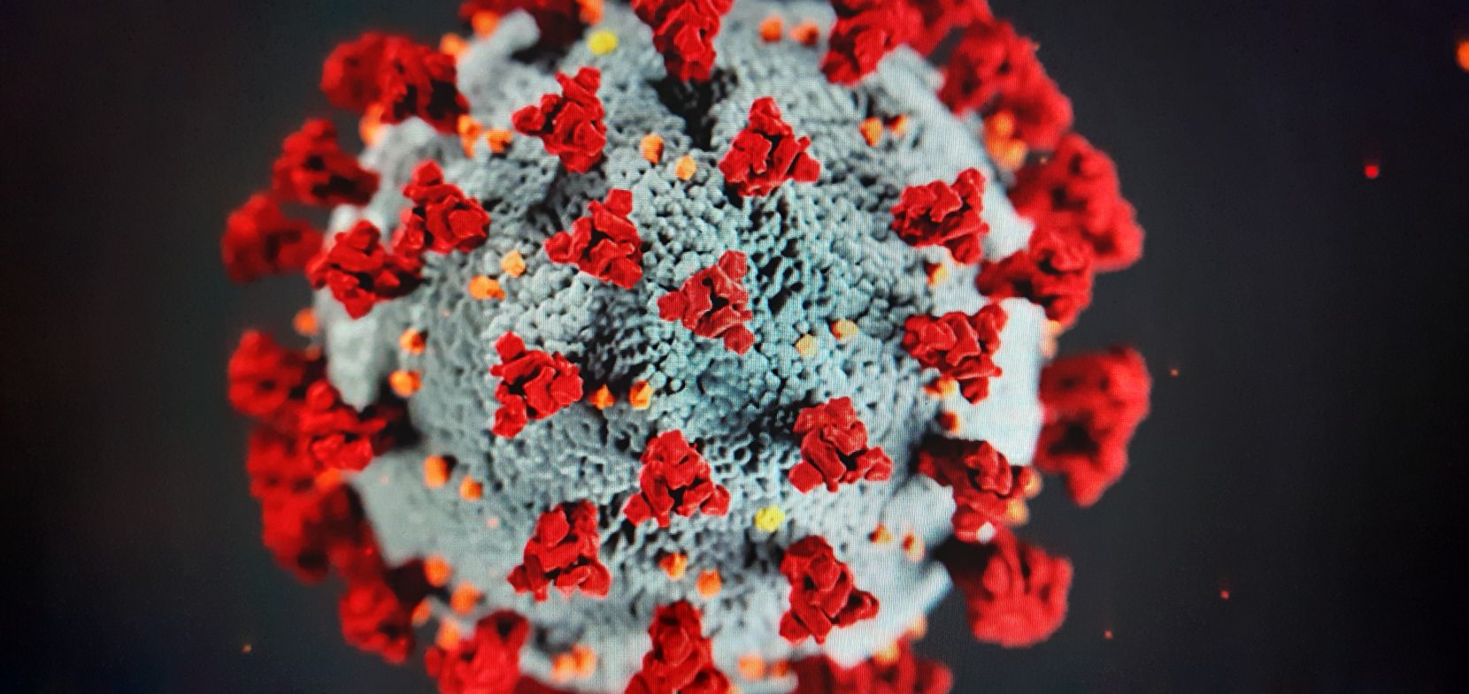 Aktuelle Situation: Coronavirus-Pandemie